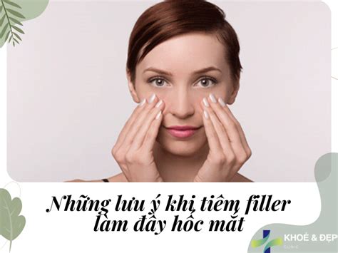 Tiêm filler đầy hốc mắt là gì Có nguy hiểm hay không