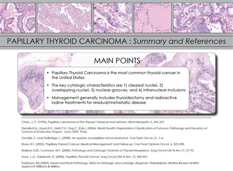 Papillary Thyroid Carcinoma | Iowa Head and Neck Protocols