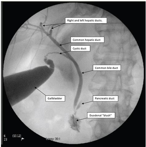 Journal Of Laparoscopy Best Scientific Journals