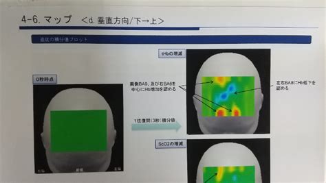 ビジョントレーニングの基礎③ 周辺視野 1｜中塚 祐馬