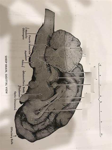 Sheep Brain Sagittal View Part 2 Diagram Quizlet