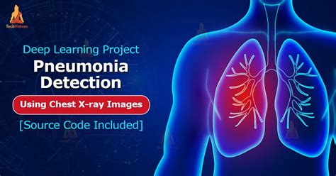 Deep Learning Pneumonia Detection Project Using Chest X Ray Images