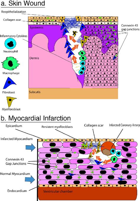 Figure 1 From Translational Lessons From Scarless Healing Of Cutaneous