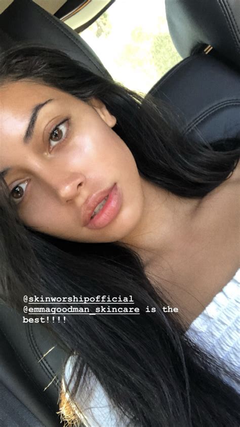 Pin By Scary Ceia On Cindy Kimberly Rhinoplasty Nose Jobs Perfect Nose Pretty Nose