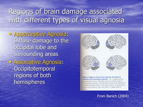 Visual Agnosia Brain