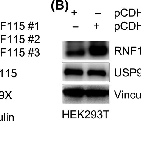 Ring Finger Protein Rnf Is Positively Correlated With