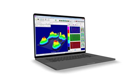 Analisi Computerizzata Del Passo Baropodometria Alma Ortopedica Mestre