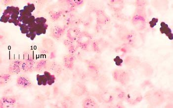 Staphylococcus haemolyticus