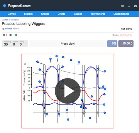 Wiggers Diagram Label Game