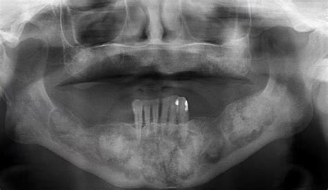 Casos Radiogr Ficos Radiodontica Ar