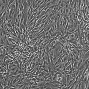 Human Trabecular Meshwork Cells - Innoprot Primary Ocular Cell System