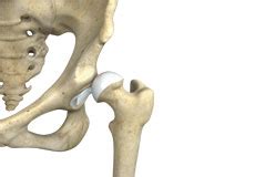 Hip Disorders Baltimore MD Groin Injuries Owings Mills MD