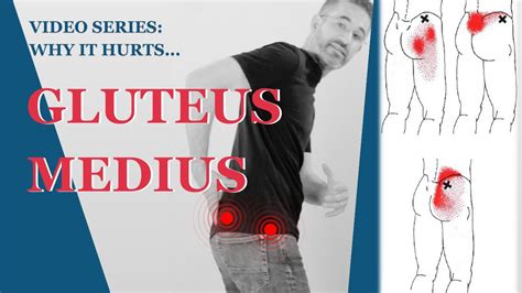 Gluteus medius pain gluteus medius pain stretches - holfbars