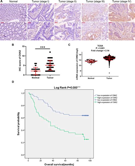 Figure 1 From CNN2 Silencing Inhibits Colorectal Cancer Development