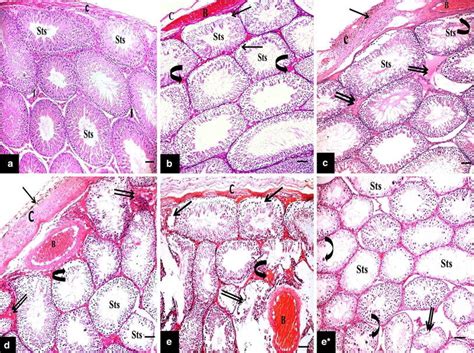 A Hande Stained Sections Of The Control Testis Showing The Covering