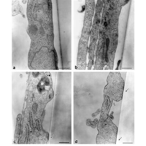 Myoepithelial Cells Morphology On Polystyrene A B C Matrigel D