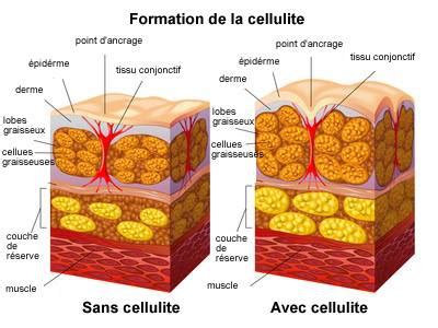 Anti Cellulite Naturel Bien Tre Sant Relaxation Massage Stress