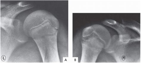 The Pediatric Athlete Musculoskeletal Key