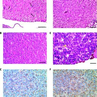 Pituitary Enlargement In Prlr Compared To Prlr Mice