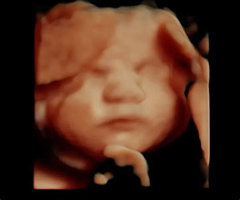 Whats The Difference Between 2d 3d 4d And 5d Ultrasounds