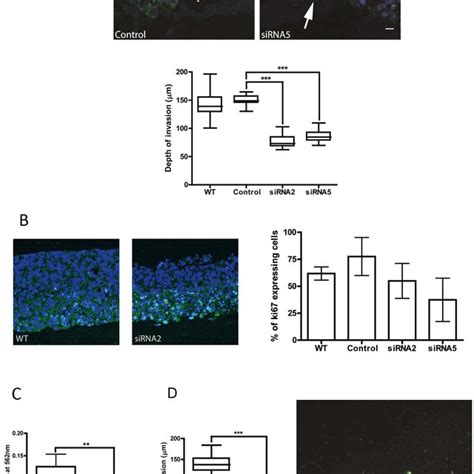 Expression Levels Of The PAK4 RAS PI3K Pathway In Pancreatic Cancer