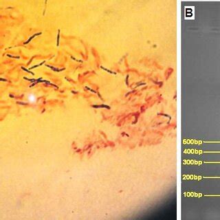 A-Gram stain of isolated fast growing Mycobacterium and B-The PCR... | Download Scientific Diagram