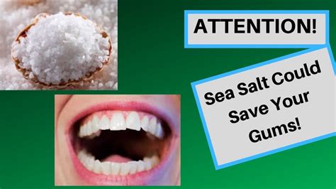 Sea Salt For Gums The Natural Cure For Gum Disease Or Bs Youtube