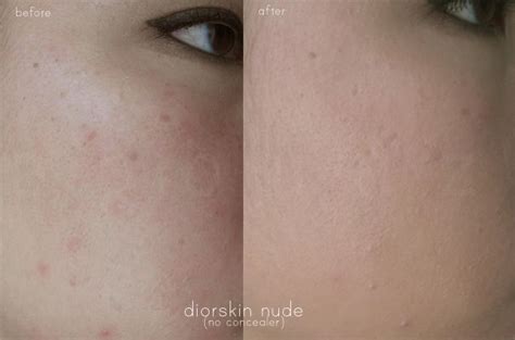 Dior Diorskin Nude Hydrating Makeup SPF DISCONTINUED Reviews MakeupAlley