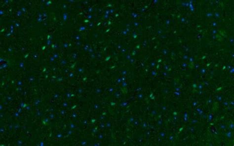 Anti Phospho CREB Ser133 Antibody Alexa Fluor 488 Conjugate From