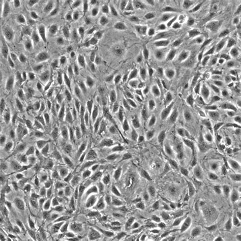 Human Mammary Vascular Endothelial Cells - Innoprot Breast Cell System