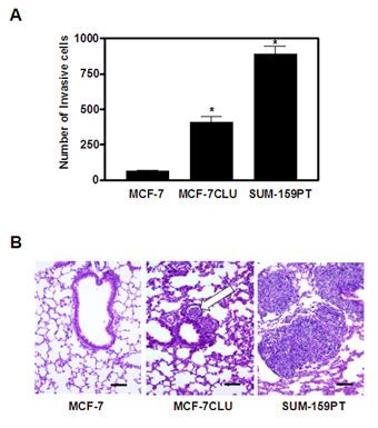 Invasive And Metastatic Potential Of MCF 7 And MCF 7CLU Panel A In