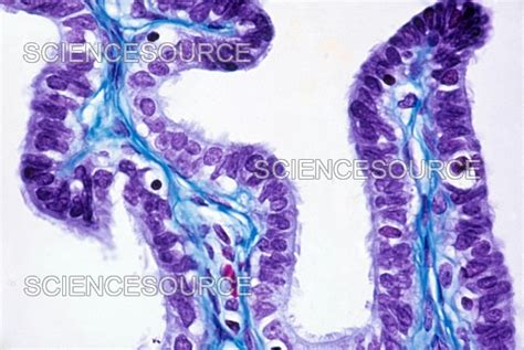 Photograph | Human Oviduct, TS | Science Source Images