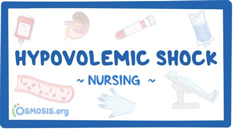 Hypovolemic Shock Chart