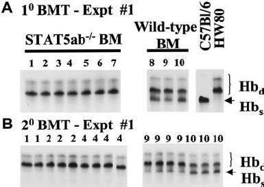 Analysis Of Hematopoietic Reconstitution After Transplantation Of Bm