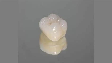 Coronas De Zirconio Ioc Clínica Dental