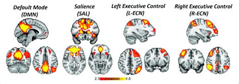 Networks Identified By Independent Component Analysis Spatial Maps Download Scientific