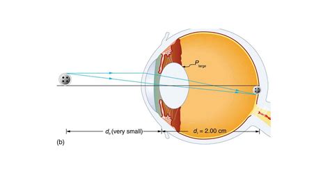 Explain How An Eye Lens Changes Its Focal Length How Does It Help In