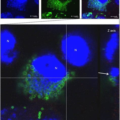 Localization Of Inclusion Bodies Formed In The Hep 2 Cells Infected