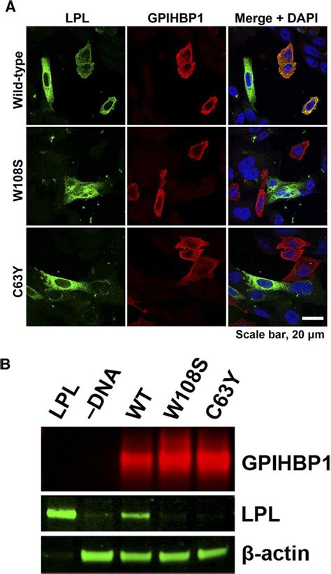 Mutating A Conserved Cysteine In GPIHBP1 Reduces Amounts Of GPIHBP1 In