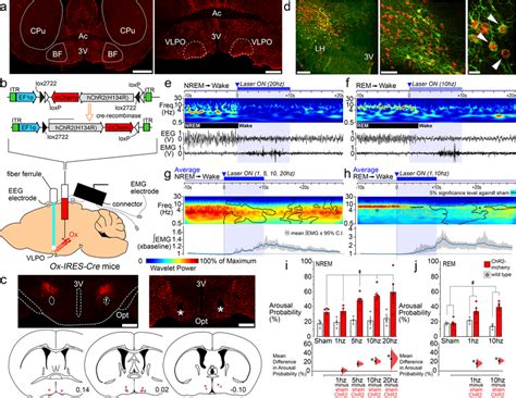 Optogenetic Stimulation Of Orexin Terminals In The Vlpo Rapidly