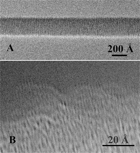 Dna Under Electron Microscope