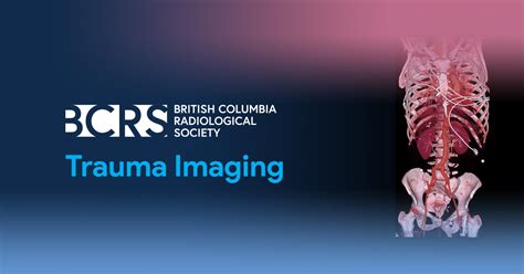 Trauma Imaging What Clinicians Want To Know From The Radiologist