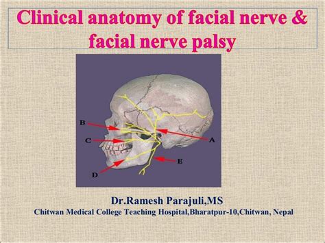 Clinical Anatomy Of Facial Nerve And Facial Nerve Palsy