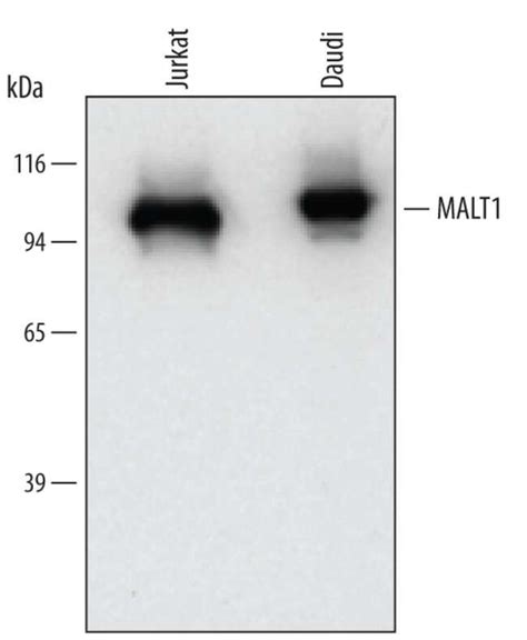 Human Malt1 Antibody R D Systems 100ug Unlabeledantibodies