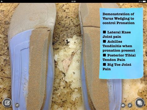 Foot And Ankle Problems By Dr Richard Blake Varus Wedging A Simple