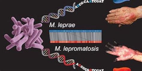 Comparing Leprosy Bacteria The Scientist Magazine®