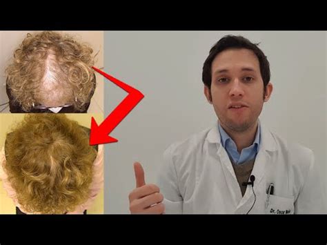 Consejos para recuperar tu cabello después de las extensiones