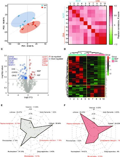 Quantitative Proteomics Analysis Of Human Bone From Osteoporosis