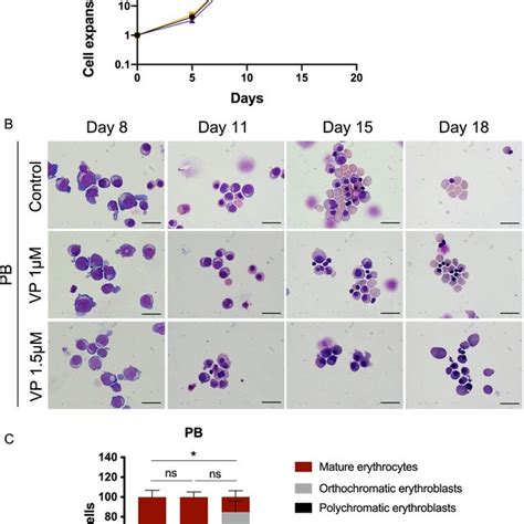 Inhibition Of Yap Taz Tead Interaction By Verteporfin Impaired