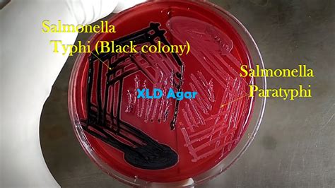 Salmonella Paratyphi Introduction Identification Features Key